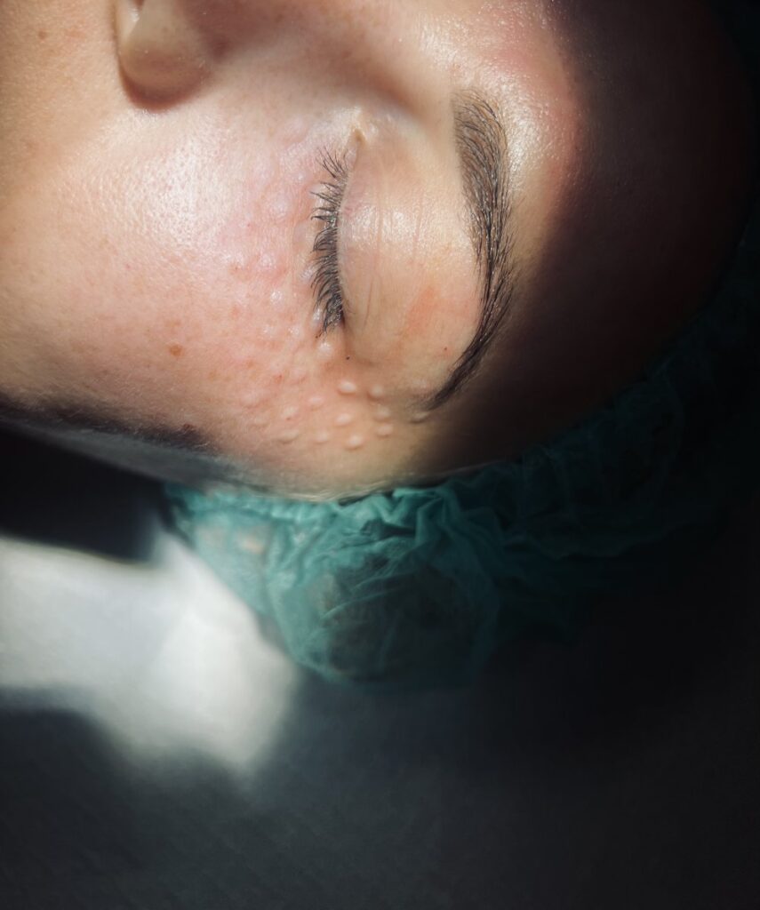 PodologicaMED Koszalin medycyna estetyczna