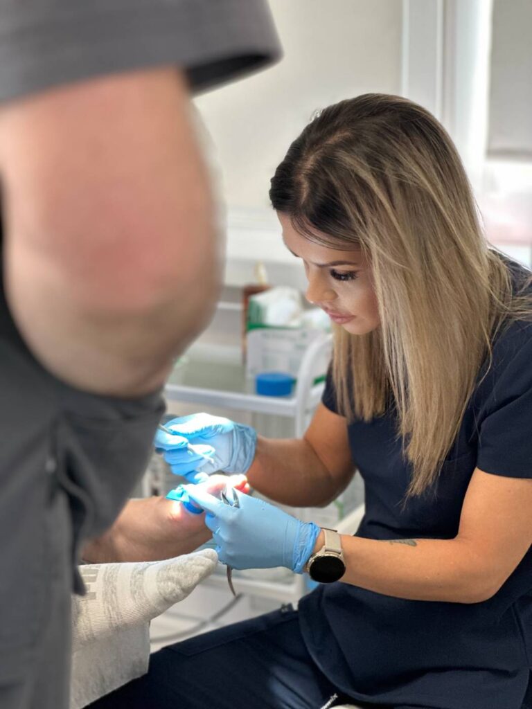 Opracowanie paznokcia u st贸p Koszalin PodologicaMED