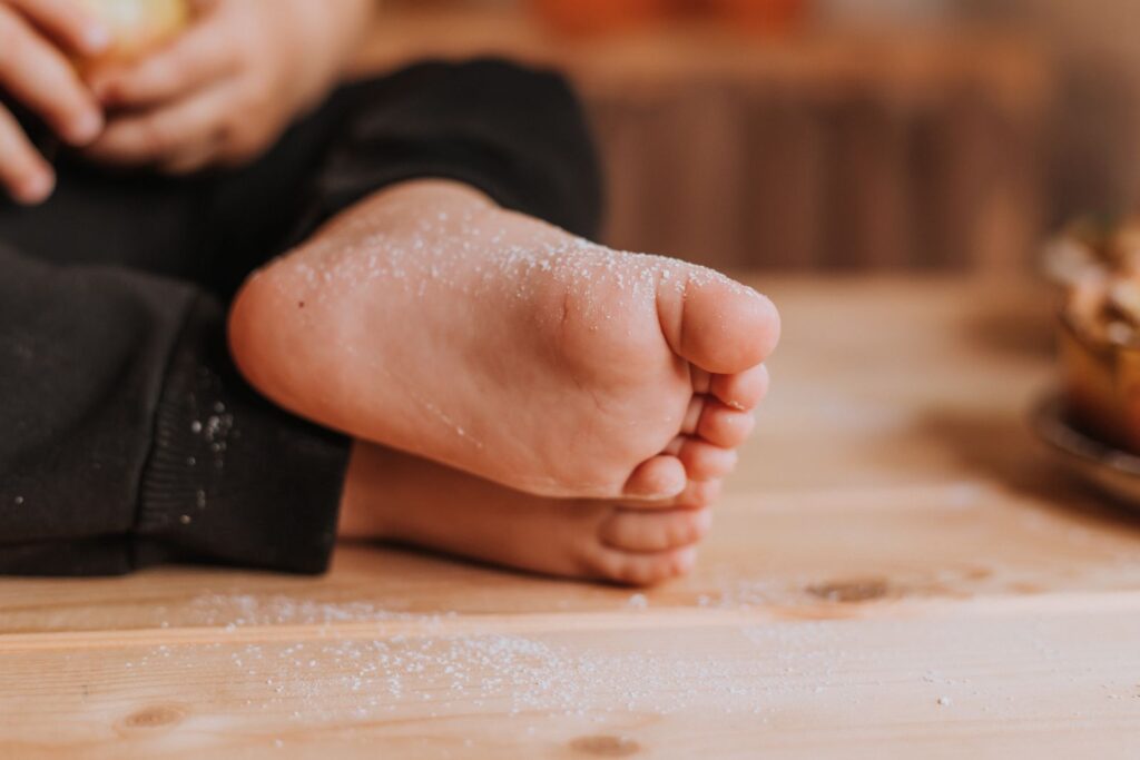 leczenie grzybicy stóp Koszalin PodologicaMED