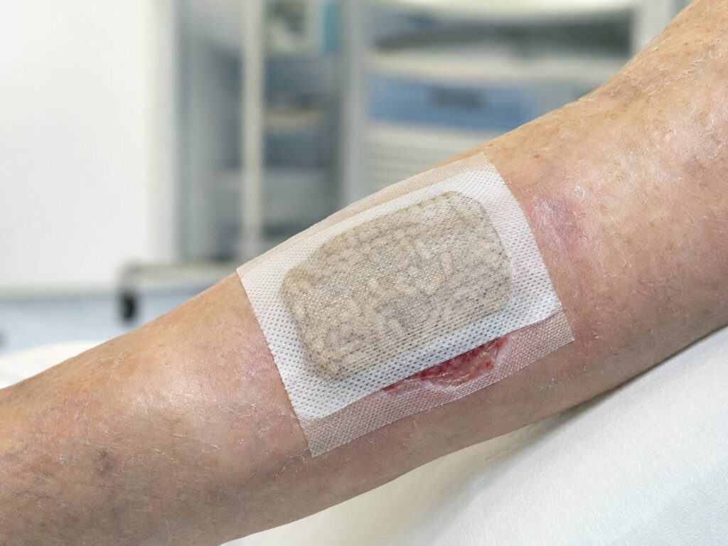 larwoterapia Koszalin PodologicaMED